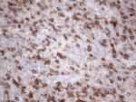 PDCD1 Antibody in Immunohistochemistry (Paraffin) (IHC (P))