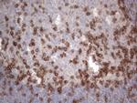 PDCD1 Antibody in Immunohistochemistry (Paraffin) (IHC (P))