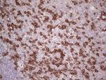 PDCD1 Antibody in Immunohistochemistry (Paraffin) (IHC (P))