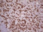 PDCD1 Antibody in Immunohistochemistry (Paraffin) (IHC (P))