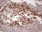 PDCD1 Antibody in Immunohistochemistry (Paraffin) (IHC (P))