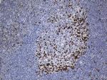 PDCD1 Antibody in Immunohistochemistry (Paraffin) (IHC (P))