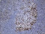 PDCD1 Antibody in Immunohistochemistry (Paraffin) (IHC (P))