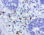 PDCD1 Antibody in Immunohistochemistry (Paraffin) (IHC (P))