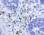 PDCD1 Antibody in Immunohistochemistry (Paraffin) (IHC (P))
