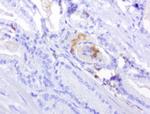 PDCD1 Antibody in Immunohistochemistry (Paraffin) (IHC (P))