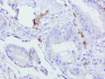 PDCD1 Antibody in Immunohistochemistry (Paraffin) (IHC (P))