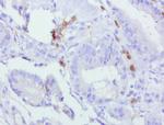 PDCD1 Antibody in Immunohistochemistry (Paraffin) (IHC (P))