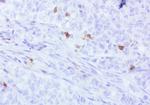 PDCD1 Antibody in Immunohistochemistry (Paraffin) (IHC (P))