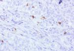 PDCD1 Antibody in Immunohistochemistry (Paraffin) (IHC (P))
