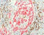 PDCD1 Antibody in Immunohistochemistry (Paraffin) (IHC (P))