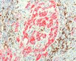 PDCD1 Antibody in Immunohistochemistry (Paraffin) (IHC (P))
