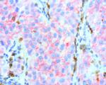 PDCD1 Antibody in Immunohistochemistry (Paraffin) (IHC (P))
