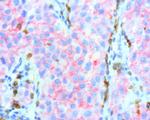 PDCD1 Antibody in Immunohistochemistry (Paraffin) (IHC (P))