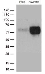 PDCD1 Antibody in Western Blot (WB)