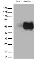 PDCD1 Antibody in Western Blot (WB)