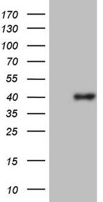 PDCD1 Antibody in Western Blot (WB)
