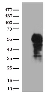 PDCD1 Antibody in Western Blot (WB)