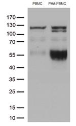 PDCD1 Antibody in Western Blot (WB)