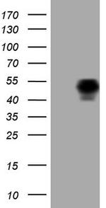 PDCD1 Antibody in Western Blot (WB)