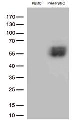 PDCD1 Antibody in Western Blot (WB)