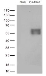 PDCD1 Antibody in Western Blot (WB)