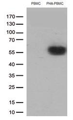 PDCD1 Antibody in Western Blot (WB)