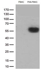 PDCD1 Antibody in Western Blot (WB)