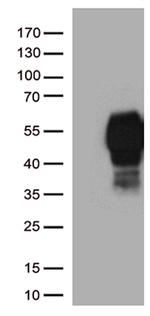 PDCD1 Antibody in Western Blot (WB)