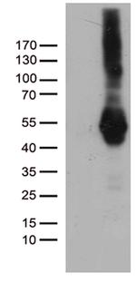PDCD2L Antibody in Western Blot (WB)