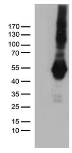 PDCD2L Antibody in Western Blot (WB)