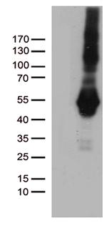 PDCD2L Antibody in Western Blot (WB)