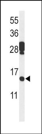 PDCD5 Antibody in Western Blot (WB)
