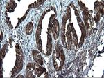 PDCD6IP Antibody in Immunohistochemistry (Paraffin) (IHC (P))