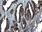 PDCD6IP Antibody in Immunohistochemistry (Paraffin) (IHC (P))
