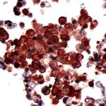 PDCD6 Antibody in Immunohistochemistry (IHC)