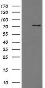 PDE10A Antibody in Western Blot (WB)