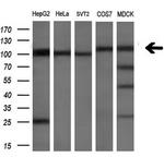 PDE2A Antibody in Western Blot (WB)