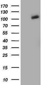 PDE2A Antibody in Western Blot (WB)