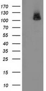 PDE2A Antibody in Western Blot (WB)