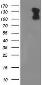 PDE2A Antibody in Western Blot (WB)