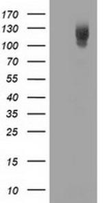 PDE2A Antibody in Western Blot (WB)