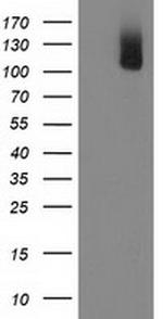 PDE2A Antibody in Western Blot (WB)
