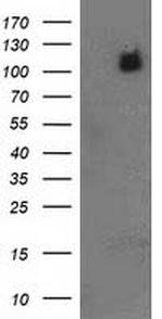 PDE2A Antibody in Western Blot (WB)