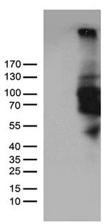 PDE3B Antibody in Western Blot (WB)