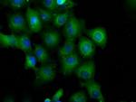 PDE4A Antibody in Immunocytochemistry (ICC/IF)