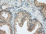PDE4A Antibody in Immunohistochemistry (Paraffin) (IHC (P))