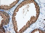 PDE4A Antibody in Immunohistochemistry (Paraffin) (IHC (P))