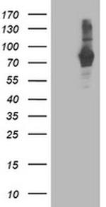 PDE4B Antibody in Western Blot (WB)