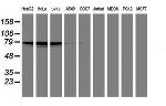 PDE4B Antibody in Western Blot (WB)